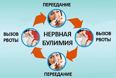 Лечение булимии в ЮАО Москвы